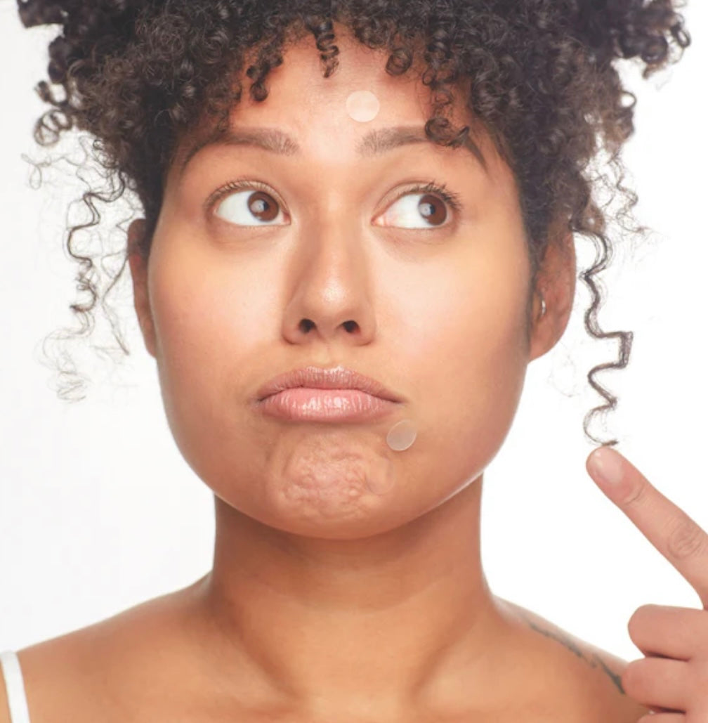 Breakout Box 3-IN-1 Acne Treatment Kit